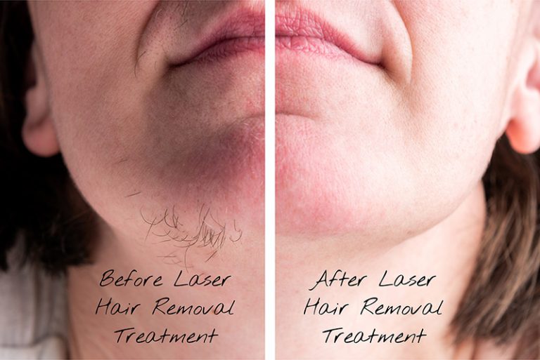 Medical Aesthetics and Lasers Expert Laser Hair Removal, Botox, and