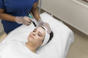 Microneedling Treatment