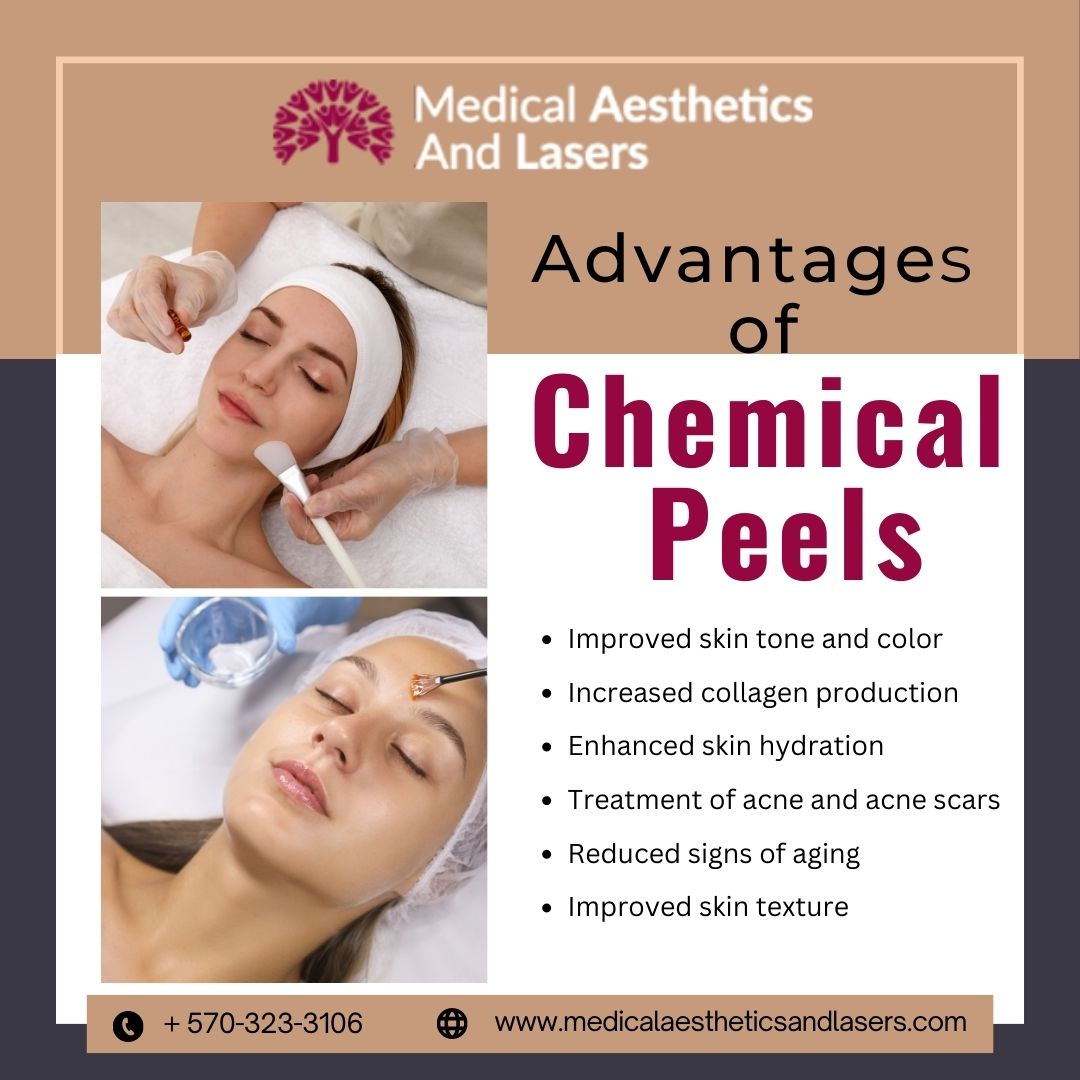 Chemical Peels Treatment , Benefits, Cost, and Precautions