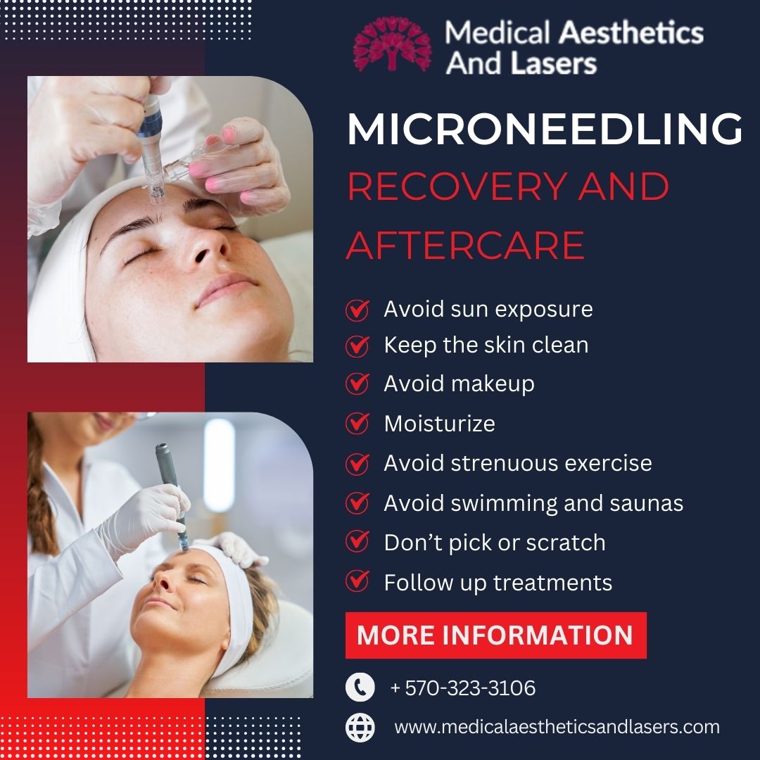 Things You Should Know About Microneedling Treatment