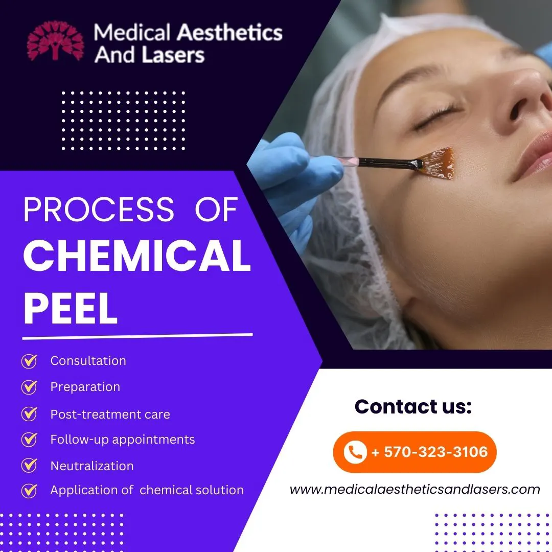 Chemical Peels Transforming Your Skin's Texture