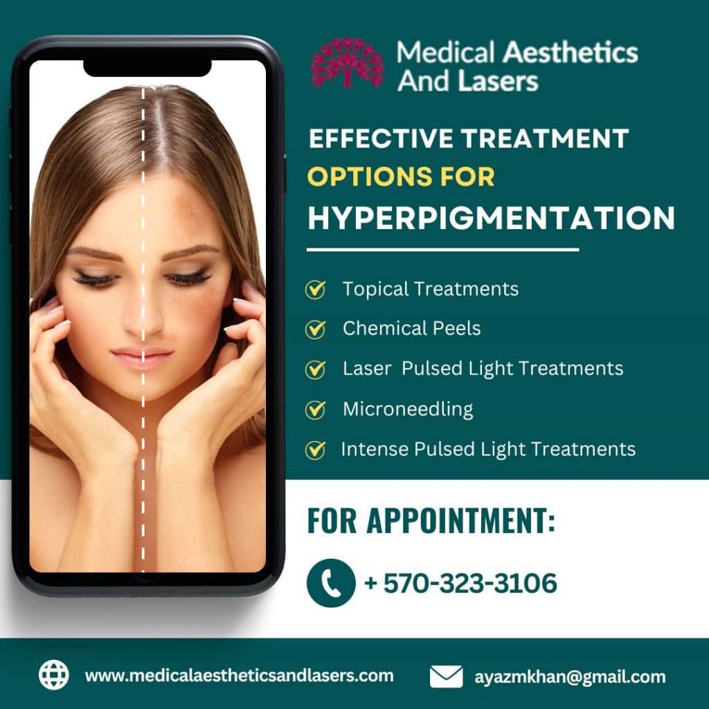 Best Hyperpigmentation Treatment Clinic in Williamsport, PA