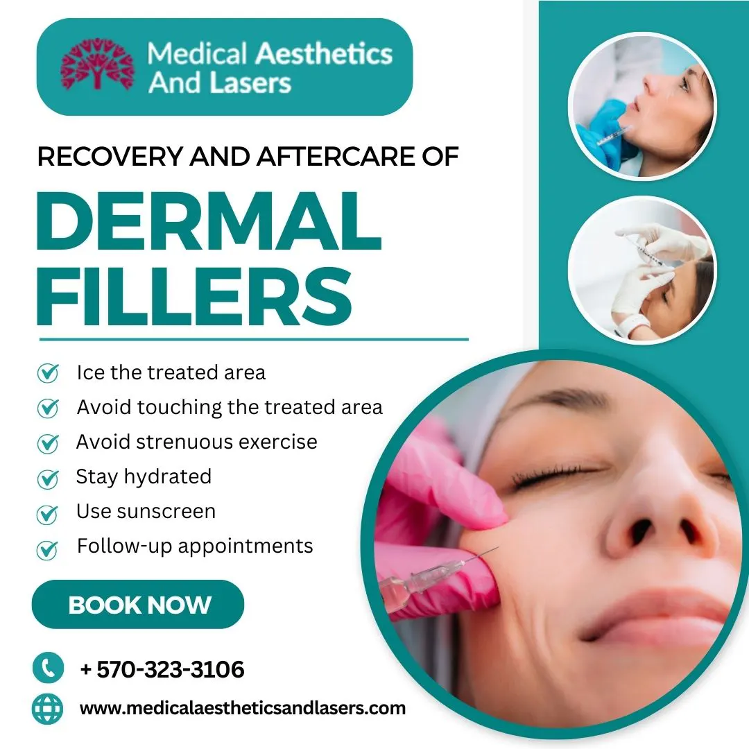 Achieving Youthful Appearance with Dermal Fillers