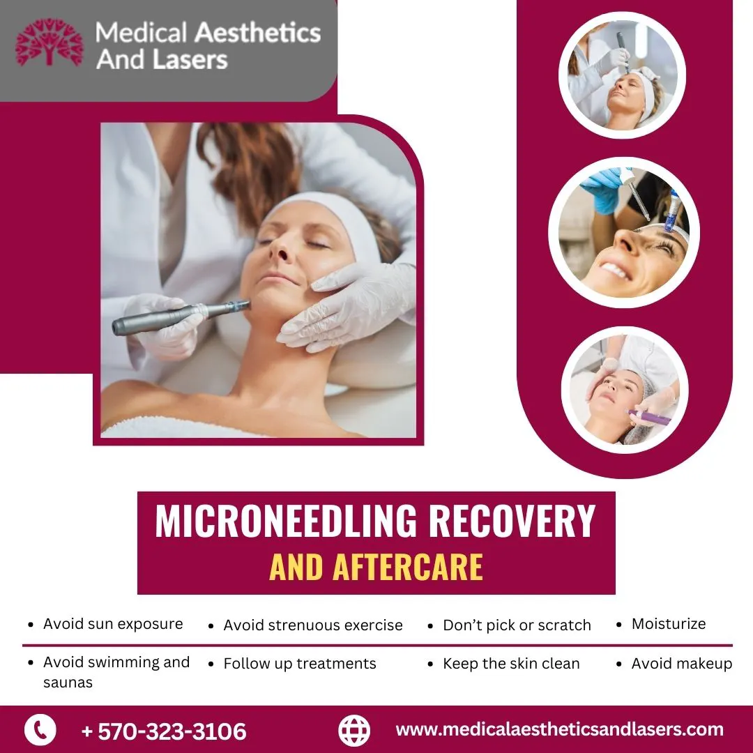 Microneedling: The Secret to Smooth and Radiant Skin   
