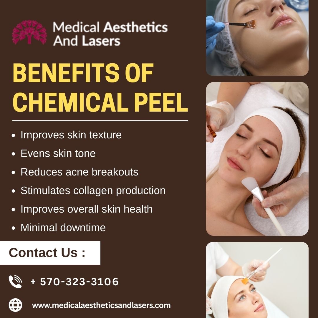 Unveiling the Magic of Chemical Peels