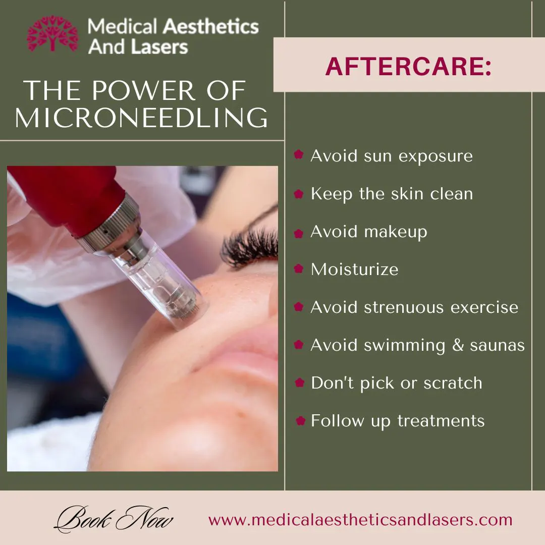 Unlocking Your Skin's Potential: The Power of Microneedling
